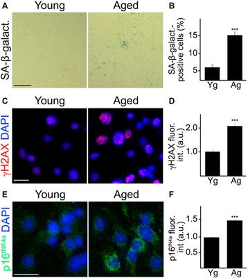 G-quadruplexes Stabilization Upregulates CCN1 and Accelerates Aging in Cultured Cerebral Endothelial Cells